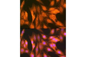 Immunofluorescence analysis of C6 cells using F/UBD Rabbit mAb (ABIN7271134) at dilution of 1:100 (40x lens).
