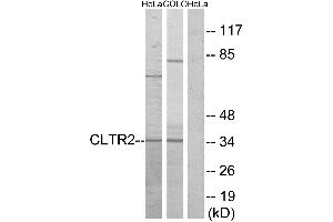 Western blot analysis of extracts from HeLa cells and COLO cells, using CLTR2 antibody. (CasLTR2 Antikörper  (Internal Region))