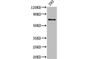 Western Blot Positive WB detected in: 293 whole cell lysate All lanes: LTA4H antibody at 3 μg/mL Secondary Goat polyclonal to rabbit IgG at 1/50000 dilution Predicted band size: 70, 60, 58, 67 kDa Observed band size: 70 kDa (LTA4H Antikörper  (AA 107-311))