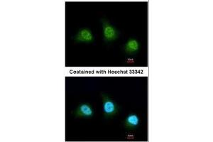ICC/IF Image Immunofluorescence analysis of paraformaldehyde-fixed HeLa, using PAD4, antibody at 1:200 dilution.