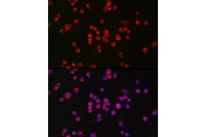 Immunofluorescence analysis of Neuro-2a cells using nNOS Rabbit mAb (ABIN1680436, ABIN1680435, ABIN7101483 and ABIN7101484) at dilution of 1:100 (40x lens). (NOS1 Antikörper)