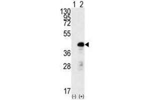 Image no. 1 for anti-SRY (Sex Determining Region Y)-Box 2 (SOX2) antibody (ABIN357439)