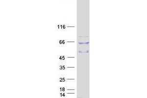 Validation with Western Blot