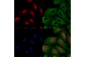 ABIN6260147 and ABIN6266767 staining  cells by IF/ICC. (ATRX Antikörper  (N-Term))