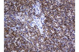 Image no. 2 for anti-NADH Dehydrogenase (Ubiquinone) 1 beta Subcomplex, 10, 22kDa (NDUFB10) antibody (ABIN1499672) (NDUFB10 Antikörper)