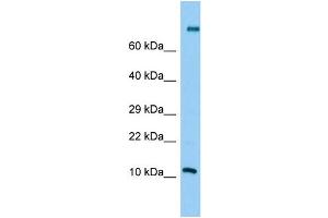 Host: Rabbit Target Name: PLA2G2C Sample Type: Jurkat Whole Cell lysates Antibody Dilution: 1. (PLA2G2C Antikörper  (Middle Region))