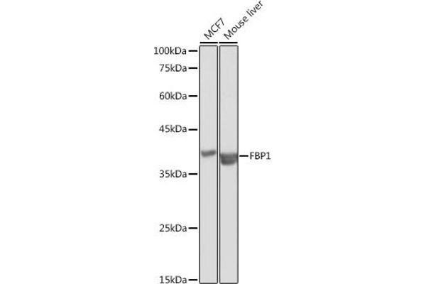 FBP1 Antikörper  (AA 1-338)