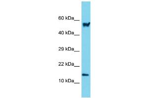 Western Blotting (WB) image for anti-Actin Related Protein 2/3 Complex, Subunit 5, 16kDa (ARPC5) (N-Term) antibody (ABIN2790140)