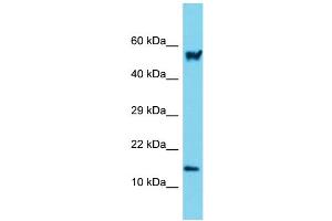 Host: Rabbit Target Name: Arpc5 Sample Type: Mouse Small Intestine lysates Antibody Dilution: 1. (ARPC5 Antikörper  (N-Term))
