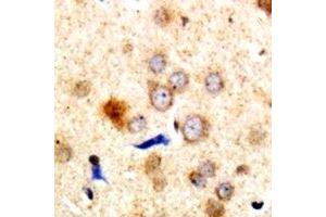 Immunohistochemical analysis of Dematin staining in human brain formalin fixed paraffin embedded tissue section. (Dematin Antikörper  (C-Term))