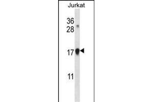 CDKN1A Antibody (C-term) (ABIN657391 and ABIN2846432) western blot analysis in Jurkat cell line lysates (35 μg/lane). (p21 Antikörper  (C-Term))