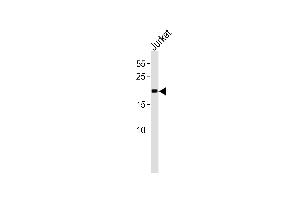 MGMT Antibody (C-term) (ABIN391514 and ABIN2841475) western blot analysis in Jurkat cell line lysates (35 μg/lane).