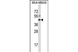 Western blot analysis in MDA-MB435 cell line lysates (35ug/lane). (RPL3 Antikörper  (AA 224-251))