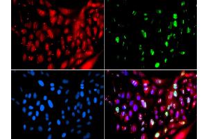 Immunofluorescence analysis of GFP-RNF168 transgenic U2OS cells using UIMC1 antibody. (UIMC1 Antikörper)