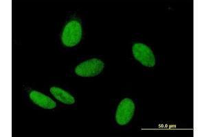 Immunofluorescence of purified MaxPab antibody to WHSC2 on HeLa cell. (WHSC2 Antikörper  (AA 1-528))