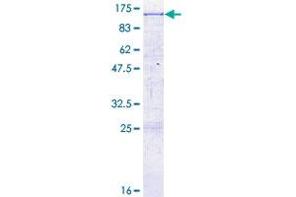 LRP10 Protein (AA 1-713) (GST tag)