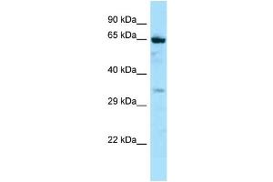 Host: Rabbit Target Name: NOX5 Sample Type: Jurkat Whole Cell lysates Antibody Dilution: 1.