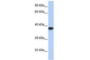 Image no. 1 for anti-DMRT-Like Family C2 (DMRTC2) (AA 72-121) antibody (ABIN6740463) (DMRTC2 Antikörper  (AA 72-121))