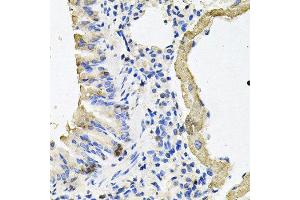 Immunohistochemistry of paraffin-embedded mouse lung using MYH7 antibody at dilution of 1:100 (x40 lens). (MYH7 Antikörper)