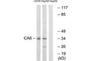 Western blot analysis of extracts from HepG2/LOVO cells, using CA6 Antibody. (CA6 Antikörper  (AA 231-280))