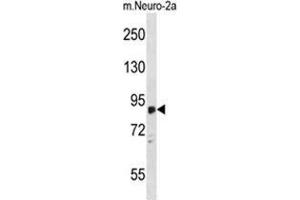 ZDHHC8 Antibody (C-term) western blot analysis in mouse Neuro-2a cell line lysates (35 µg/lane). (ZDHHC8 Antikörper  (C-Term))