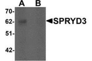 Western blot analysis of SPRYD3 in human brain tissue lysate with SPRYD3 antibody at 1 μg/ml in (A) the absence and (B) the presence of blocking peptide. (SPRYD3 Antikörper  (Center))