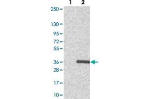 Western blot analysis of Lane 1: Negative control (vector only transfected HEK293T lysate). (ADO Antikörper)