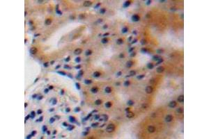 Used in DAB staining on fromalin fixed paraffin-embedded Kidney tissue (VEGFA Antikörper  (AA 27-146))