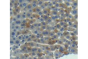 Used in DAB staining on fromalin fixed paraffin- embedded liver tissue (RGS10 Antikörper  (AA 16-181))