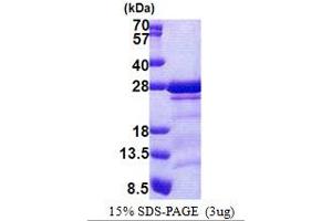 SDS-PAGE (SDS) image for Calcium Modulating Ligand (CAMLG) (AA 1-189) protein (His tag) (ABIN5853110) (CAMLG Protein (AA 1-189) (His tag))