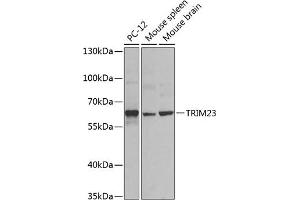 Western blot analysis of extracts of various cell lines, using TRIM23 antibody (ABIN6131175, ABIN6149508, ABIN6149509 and ABIN6224352) at 1:1000 dilution. (TRIM23 Antikörper  (AA 1-280))