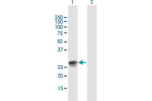 Western Blot analysis of SSX2 expression in transfected 293T cell line by SSX2 MaxPab polyclonal antibody. (SSX2 Antikörper  (AA 1-188))