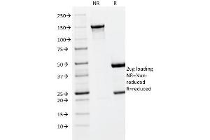 SDS-PAGE Analysis Purified PLGF Monoclonal Antibody (PLGF/93). (PLGF Antikörper)