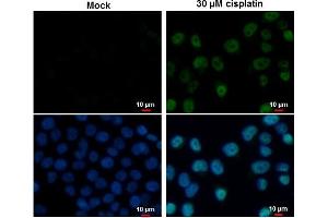 ICC/IF Image p53 antibody [N1], N-term detects p53 protein at nucleus by immunofluorescent analysis. (p53 Antikörper  (N-Term))