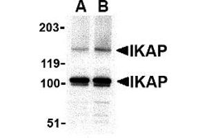 Western Blotting (WB) image for anti-Elongator Complex Protein 1 (ELP1) (C-Term) antibody (ABIN1030431) (IKAP/p150 Antikörper  (C-Term))