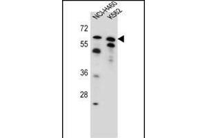 PLAG1 Antibody (N-term) (ABIN655594 and ABIN2845080) western blot analysis in NCI-,K562 cell line lysates (35 μg/lane). (PLAG1 Antikörper  (N-Term))
