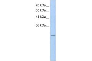 Western Blotting (WB) image for anti-Ret Finger Protein-Like 3 (RFPL3) antibody (ABIN2462662) (RFPL3 Antikörper)