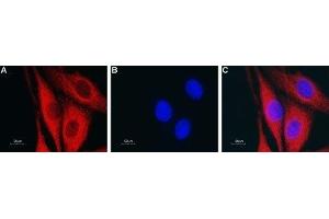 Expression of Aquaporin 4 in rat glioma C6 cells - Immunocytochemical staining of fixed and permeabilized rat glioma C6 cells. (Aquaporin 4 Antikörper  (C-Term, Intracellular))