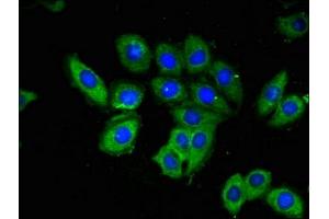 Immunofluorescent analysis of A549 cells using ABIN7142174 at dilution of 1:100 and Alexa Fluor 488-congugated AffiniPure Goat Anti-Rabbit IgG(H+L) (OAS3 Antikörper  (AA 424-565))