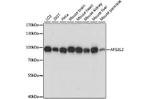 Western blot analysis of extracts of various cell lines, using AFG3L2 antibody (ABIN6292744) at 1:1000 dilution. (AFG3L2 Antikörper)