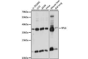Western blot analysis of extracts of various cell lines, using RPL6 antibody (ABIN7270010) at 1:1000 dilution. (RPL6 Antikörper  (AA 188-288))