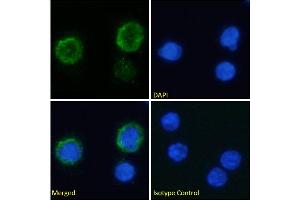Immunofluorescence staining of fixed human peripheral blood monocytes (PBMs) with anti-C3a-receptor antibody 3G7. (Rekombinanter C3AR1 Antikörper)