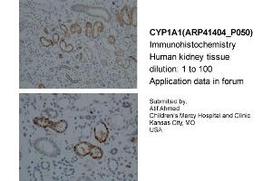 Sample Type: Human KidneyDilution: 1:100 (CYP1A1 Antikörper  (Middle Region))