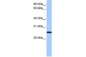 FBXO36 antibody used at 1 ug/ml to detect target protein. (FBXO36 Antikörper  (N-Term))