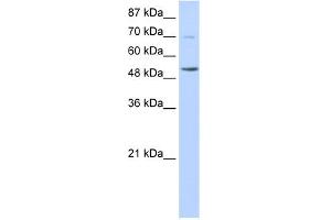 WB Suggested Anti-IKZF3 Antibody Titration:  0. (IKZF3 Antikörper  (N-Term))