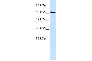 WB Suggested Anti-UBP1 Antibody Titration:  0. (UBP1 Antikörper  (Middle Region))