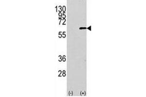 Western blot analysis of AKT1 antibody and 293 cell lysate (2 ug/lane) either nontransfected (Lane 1) or transiently transfected with the human gene (2). (AKT1 Antikörper  (AA 115-144))