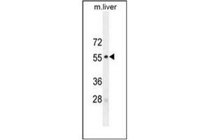 Western blot analysis of MAPK8 / JNK1 Antibody (Thr183/Tyr185) in mouse liver tissue lysates (35ug/lane). (JNK Antikörper  (AA 162-199))