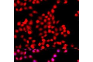 Immunofluorescence analysis of A549 cells using TTBK2 Polyclonal Antibody (TTBK2 Antikörper)