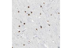Immunohistochemical staining (Formalin-fixed paraffin-embedded sections) of human cerebral cortex with ZIC1 polyclonal antibody  shows strong nuclear positivity in neuronal and glial cells.